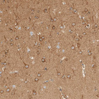 Anti-RABEP1 Antibody