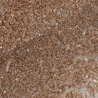 Immunohistochemical staining of human tonsil shows strong cytoplasmic and membranous positivity in cells in germinal and non germinal center cells.
