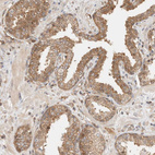 Immunohistochemical staining of human prostate shows moderate cytoplasmic membranous positivity in glandular cells.