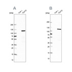 Western blot analysis using Anti-RABEP1 antibody HPA024235 (A) shows similar pattern to independent antibody HPA019669 (B).