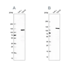 Western blot analysis using Anti-RABEP1 antibody HPA024235 (A) shows similar pattern to independent antibody HPA019669 (B).