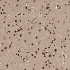 Anti-CPSF2 Antibody