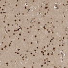 Anti-CPSF2 Antibody