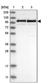 Lane 1: Marker [kDa] 230, 130, 95, 72, 56, 36, 28, 17, 11_br/_Lane 2: Human cell line RT-4_br/_Lane 3: Human cell line U-251MG sp