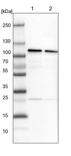 Lane 1: NIH-3T3 cell lysate (Mouse embryonic fibroblast cells)_br/_Lane 2: NBT-II cell lysate (Rat Wistar bladder tumour cells)