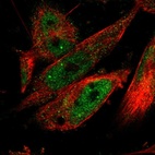 Immunofluorescent staining of human cell line U-251 MG shows localization to nucleoplasm.