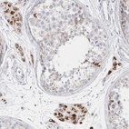 Anti-FAM71F2 Antibody