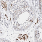 Immunohistochemical staining of human testis shows high expression.