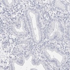 Anti-FAM71F2 Antibody