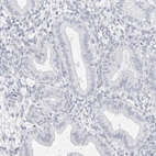 Immunohistochemical staining of human endometrium shows low expression as expected.