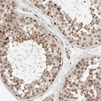 Immunohistochemical staining of human testis shows moderate to strong nuclear positivity in cells in seminiferous ducts.