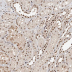 Immunohistochemical staining of human kidney shows weak to moderate nuclear positivity in cells in tubules.