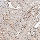 Immunohistochemical staining of human kidney shows weak to moderate nuclear positivity in cells in tubules.