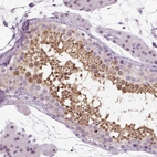 Immunohistochemical staining of human testis shows high expression.