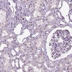 Immunohistochemical staining of human kidney shows low expression as expected.
