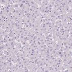 Anti-POPDC2 Antibody