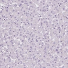 Immunohistochemical staining of human liver shows no positivity in hepatocytes as expected.