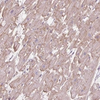 Immunohistochemical staining of human heart muscle shows moderate membranous positivity in cardiomyocytes.