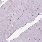 Immunohistochemical staining of human skeletal muscle shows no positivity in myocytes as expected.