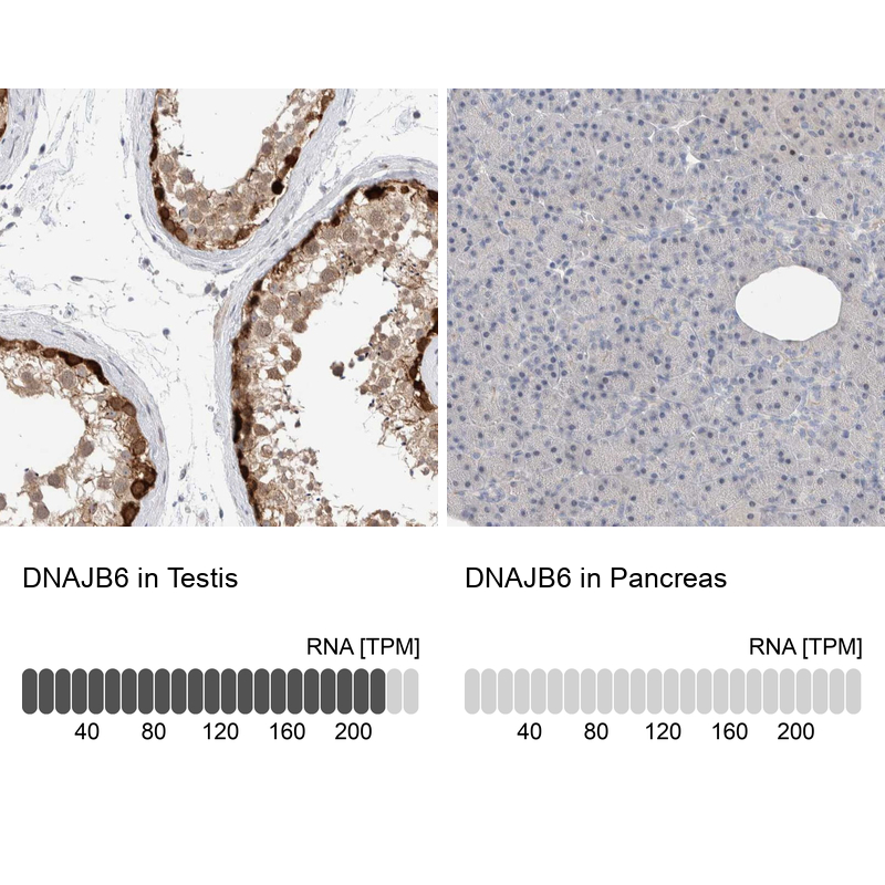 Anti-DNAJB6 Antibody