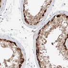Immunohistochemical staining of human testis shows high expression.