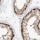 Immunohistochemical staining of human testis shows high expression.