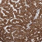 Anti-WDR91 Antibody