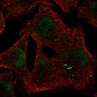 Immunofluorescent staining of human cell line RH-30 shows localization to nucleoplasm & cytoplasmic bodies.