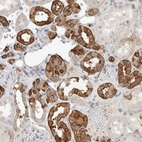 Immunohistochemical staining of human kidney shows high expression.