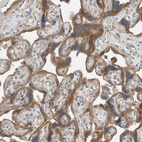 Anti-SEL1L Antibody