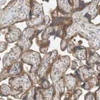 Anti-SEL1L Antibody