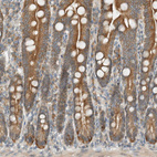 Immunohistochemical staining of human duodenum shows moderate cytoplasmic positivity in glandular cells.