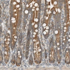 Immunohistochemical staining of human duodenum shows moderate cytoplasmic positivity in glandular cells.