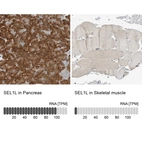 Immunohistochemistry analysis in human pancreas and skeletal muscle tissues using HPA024267 antibody. Corresponding SEL1L RNA-seq data are presented for the same tissues.