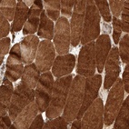 Anti-PRDM15 Antibody