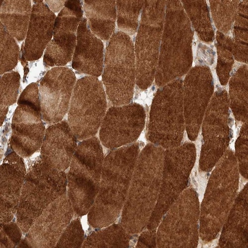 Anti-PRDM15 Antibody
