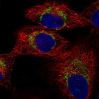 Anti-TRMT61A Antibody