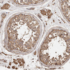 Immunohistochemical staining of human Testis shows moderate cytoplasmic positivity in cells in seminiferous ducts and Leydig cells.