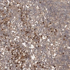 Immunohistochemical staining of human Lymph node shows moderate granular cytoplasmic positivity in non-germinal center cells.