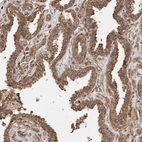 Immunohistochemical staining of human Prostate shows moderate granular cytoplasmic positivity in glandular cells.