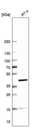 Western blot analysis in human cell line RT-4.
