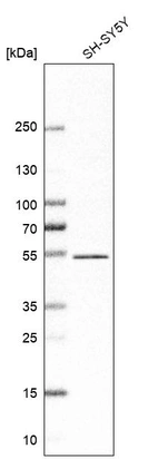Anti-ZNF704 Antibody