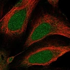 Immunofluorescent staining of human cell line U-2 OS shows localization to nucleoplasm & cytosol.