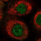 Immunofluorescent staining of human cell line A-431 shows localization to nucleoplasm.