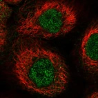 Immunofluorescent staining of human cell line A-431 shows localization to nucleoplasm.