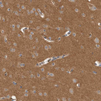 Anti-DMTN Antibody