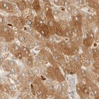 Immunohistochemical staining of human liver using Anti-TACO1 antibody HPA024294.