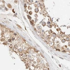 Immunohistochemical staining of human testis using Anti-TACO1 antibody HPA024294.