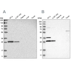 Western blot analysis using Anti-TACO1 antibody HPA024294 (A) shows similar pattern to independent antibody HPA021626 (B).