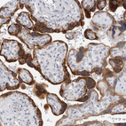 Immunohistochemical staining of human placenta shows strong cytoplasmic positivity in trophoblastic cells.